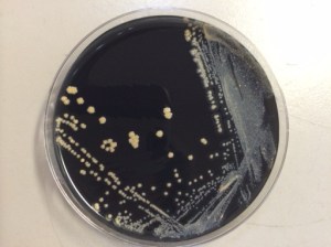 Isolated growth on BCYE media.