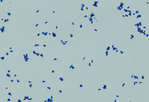 Gram stain showing gram positive bacilli with subtle palisading arrangements and formations that resemble Chinese letters. 