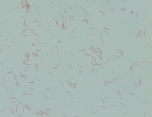 Gram stain of organism 1