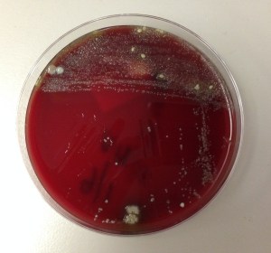 Anaerobic blood agar plate showing predominately two colony types