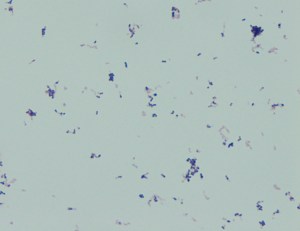 Gram stain of organism 2