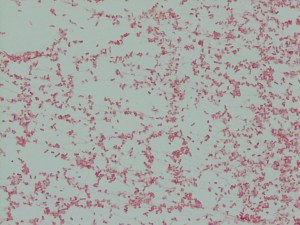 Colony Gram stain showing Gram-negative bacilli