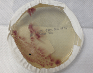 Fuschia colonies growing on CHROMagar O157. 