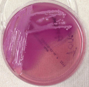 MacConkey agar growing mucoid lactose fermenting (pink) bacterial colonies.