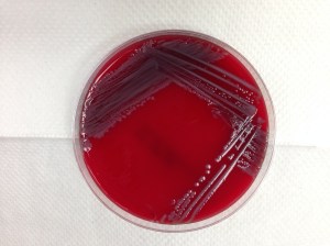 White-grey bacterial colonies growing on blood agar plate. 