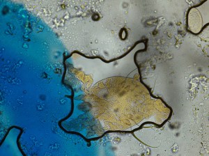 Sarcoptes scabiei  (the itch mite) from skin scraping.