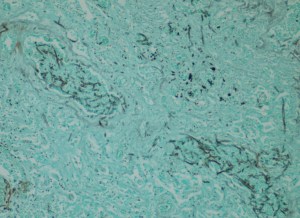 Lung tissue, vasculature; silver stain, 10x