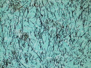 Lung tissue, areas of necrosis; silver stain, 10x