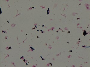 Large Gram-positive boxcar shaped bacilli. 