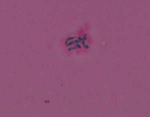 Poor-staining, beaded Gram positive bacilli in clumps and cords.