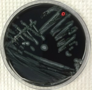 Legionella on BCYE agar plate