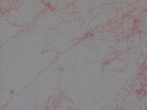 Gram negative, thin, short-to-filamentous rod shaped organisms