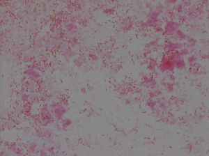 Gram stain of Yersinia enterocolitica reveals Gram-negative bacilli