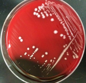 CSF aerobic culture on blood agar