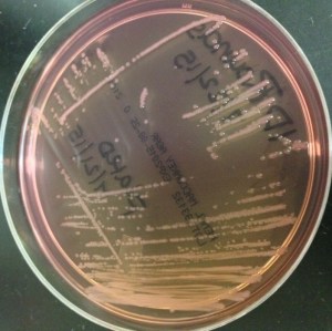 CSF aerobic culture on MacConkey