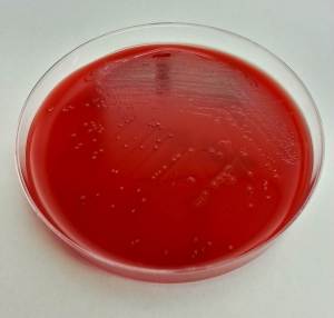 Tiny gray colonies on blood agar with a bleach-like odor.