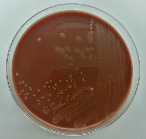 Small, pale yellow colonies on chocolate agar.