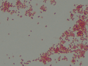 N. gonorrhoeae is a gram negative diplococci responsible for the disease of gonorrhea. Though most specimens for gonorrhea are received from sources suspected of having the disease, it should be noted that whenever dealing with a gram negative diplococci of unknown source, care should be taken, and the specimen should be handled under a hood for possible exposure to N. meningitidis.