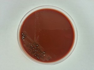 Cultures can also be innoculated onto chocolate agar. Notice the smaller grey colonies, which is the N. gonorrhoeae.  Notice the other colonies on the plate, as chocolate agar is not a selective medium.