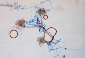 Scotch-tape preparation reveals rarely septate hyphae with internodal rhizoids and pyriform sporangia supported by funnel-shaped apophyses.