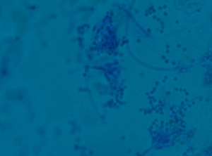 Note that the elongated Phialides, and taper to a long slender tube, resembling bowling pins.  Sometimes this morphology has also been referred to as "skeleton hands."