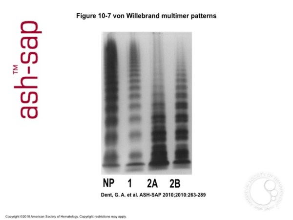 Von Willebrand Disease – Lablogatory