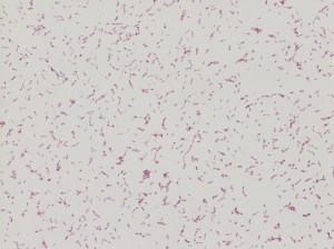 Kinyoun stain revealing broad rods with cross-barring.