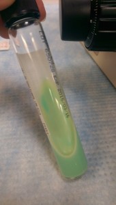 Colony growth on Lowenstein-Jensen medium.