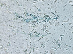 Organism morphology on lactophenol analine blue scotch tape prep. 