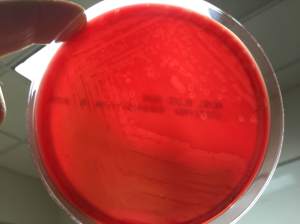 Small zones of beta hemolysis around colonies growing on 5% sheep blood agar