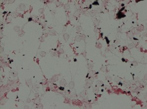 Gram stain demonstrating Gram-negative rods.