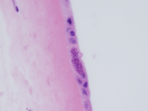Figure 1b: Amnion of the fetal membrane: Round to elongate cysts measuring approximately 50 microns in diameter. There are innumerable small round “dot-like” structures within the cysts (H&E, 600X). 