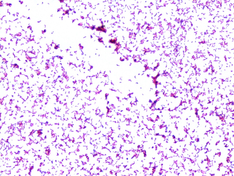 Mycobacterium Gram Stain Results NQFLWV Mycobacterium Gram Stain Results NQFLWV