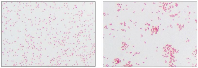 Microbiology Case Study: 3-year-old Female with Facial Wound – Lablogatory