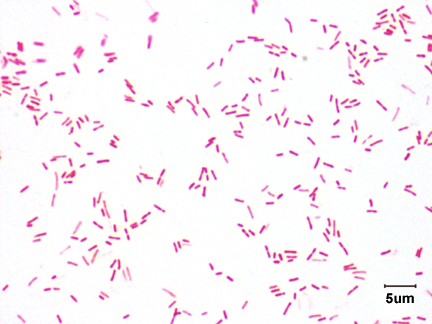 Microbiology Case Study: A 10 Year Old Girl with New Onset Fever