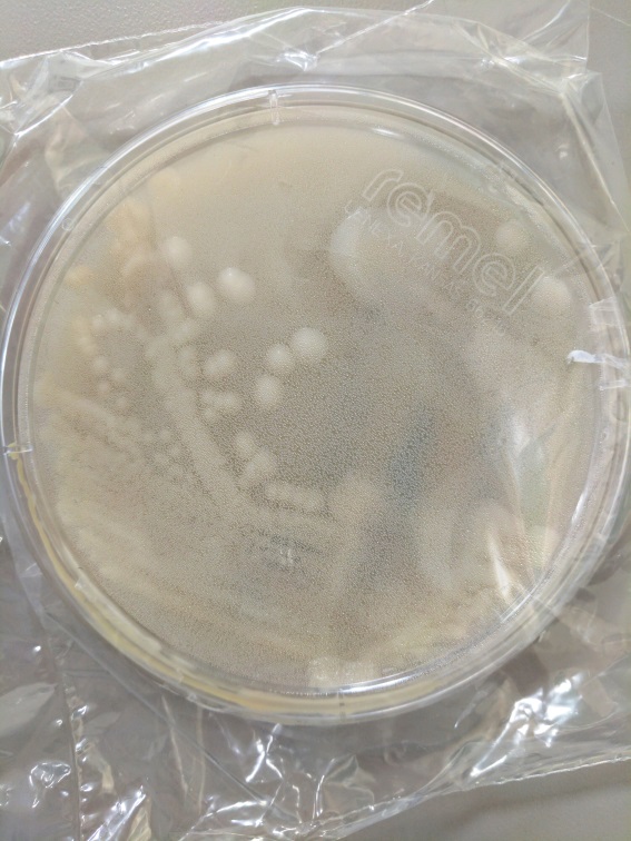 Microbiology Case Study: A 74 Year Old Man’s BAL Specimen – Lablogatory