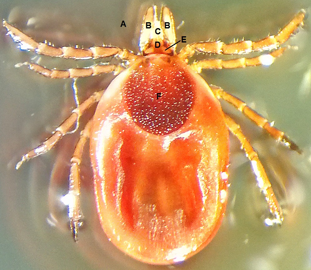 Microbiology Case Study: A 51-Year-Old Woman with a Tick Bite
