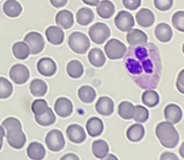 gray-platelet-small