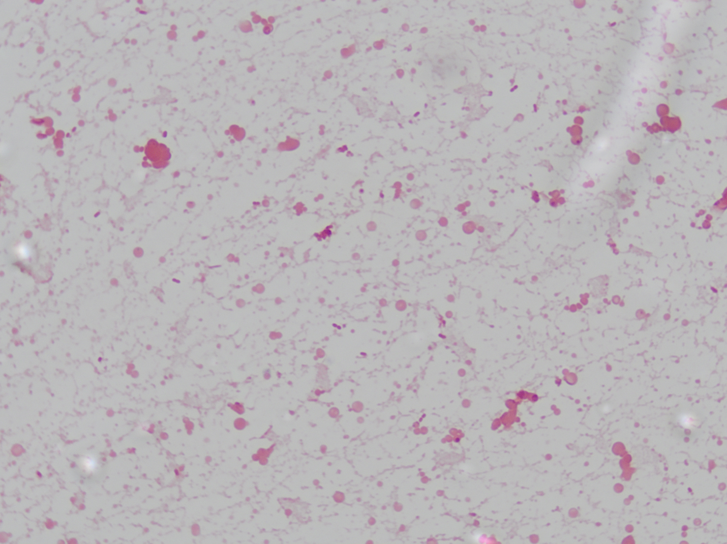 Microbiology Case Study: 42 Year Old Male with Bilateral Lower ...
