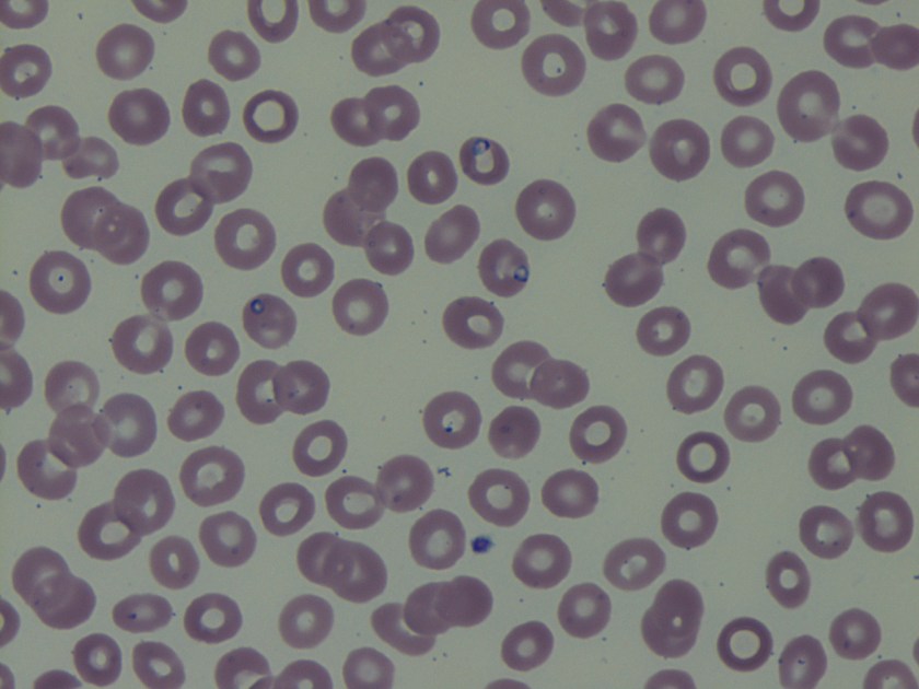 babesia