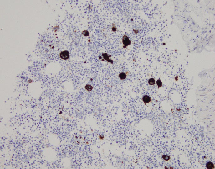2-cases-CD61