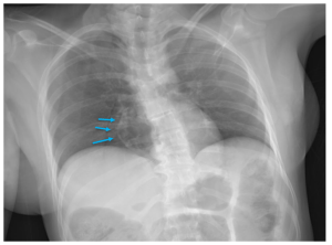 It’s What’s on the Inside That Counts: Uses of Radiography at Autopsy ...
